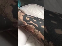 टैटू हटाने के लिए पिको दूसरी लेजर मशीन